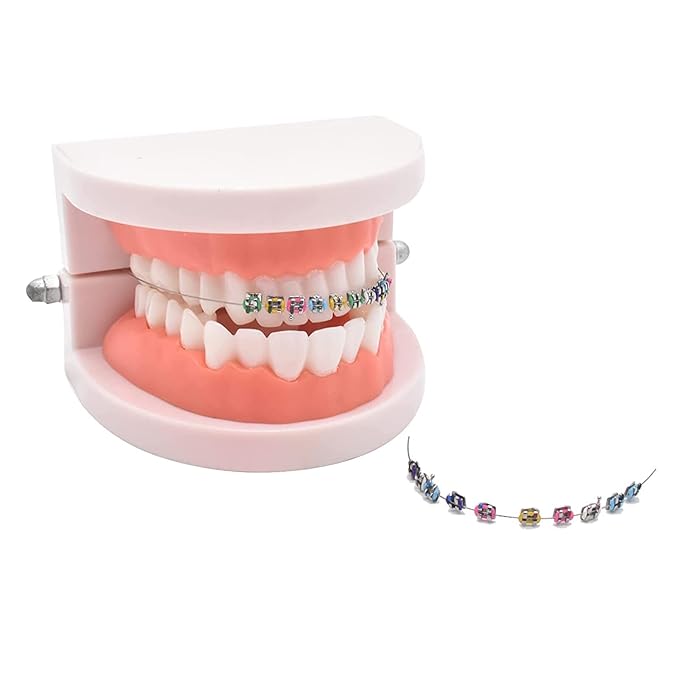 1 Pack Temporary Tooth Decoration with Metal Wires,Metal Bracket and Orthodontic Ligature Ties,Practice Props for Dental Students,Orthodontist Explain Props ( Multiple Colors)