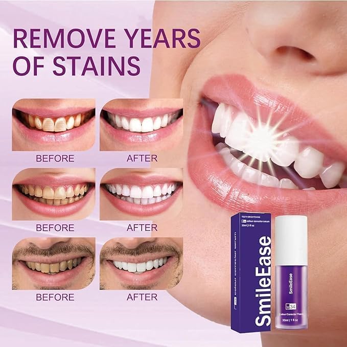 Purple Toothpaste for Teeth Whitening, Purple Whitening Toothpaste for Adults,Tooth Stain Remover Gel - Tooth Whitener Suitable for Smoking, Coffee, and Removing Dental Stone ﻿ (2fl oz/60ml) ﻿