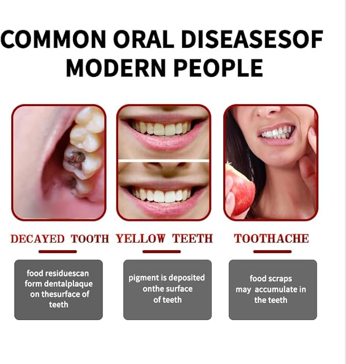 2 Pcs SP-8 Probiotic Whitening Toothpaste, Triple Whitening Care Deep Cleaning Fresh Breath.