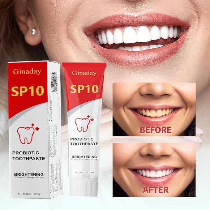 2 Pcs SP10 Probiotic Whitening Toothpaste, Deep Cleaning Care Remove Yellow Tooth Stains, with Probiotic Oral Health Management, Fresh Breath.