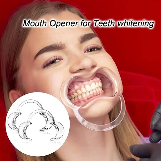 30-Pack Dental Cheek Retractor, Professional Autoclavable Mouth Opener Retractors, 100% BPA-Free, for Dentist, Teeth Whitening, Party, Mouthguard Challenge Game - Size M, Clear