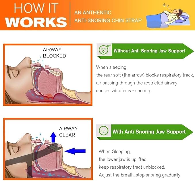 2025 Model Anti Snoring Chin Strap, Stop Snoring Chin Straps for CPAP Users, Jaw Strap for Sleeping,Chin Straps to Keep Mouth Closed for Sleeping Better, Cpap Chin Strap for Sleep for Men- Women