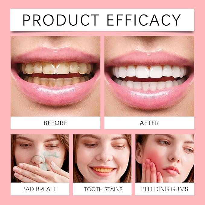 2 Pcs SP10 Probiotic Toothpaste - Whitening Toothpaste, Fresh Breath Formula，Stain Removal，Deep Cleaning Care