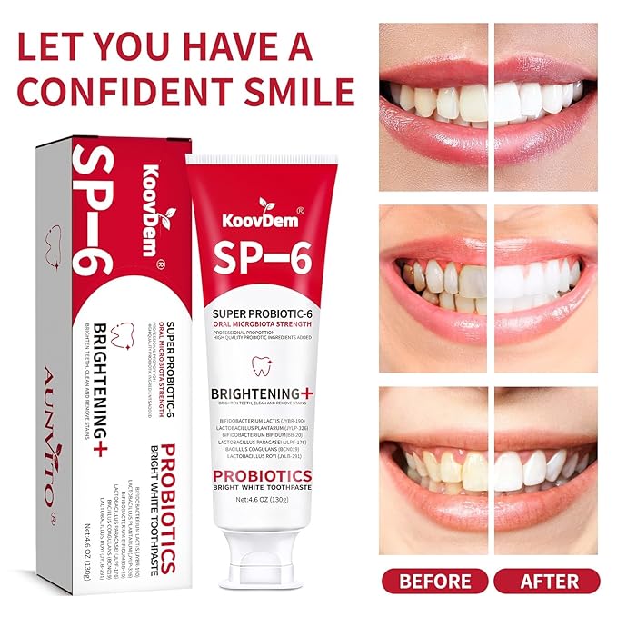 2025 New Sp-6 Probiotics Whitening Toothpaste-Fluoride-Free, Enhanced Formula with 6 Probiotics for Gum Care & Fresh Breath, Fresh Mint Flavor(2PC)（Red）