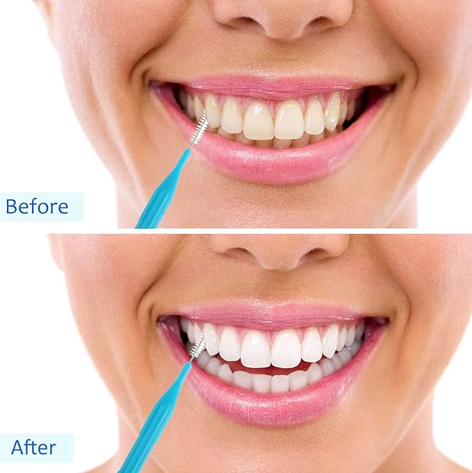 100 Pieces Braces Brush for Cleaner Interdental Brush Toothpick Dental Flossing Head Oral Hygiene Flosser Tooth Cleaning Tool (Light Blue, Yellow, Gray, Purple, Green)