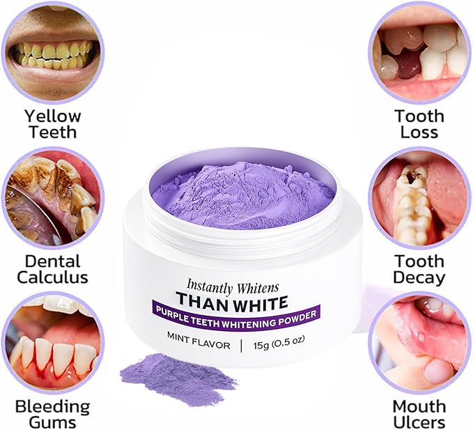 Purple Teeth Whitening Powder, Advanced Tooth Restoration Powder, Natural Teeth Restoration Powder-15g, Professional Oral Care, Protect Gums and Freshen Breat (2 Bottle)
