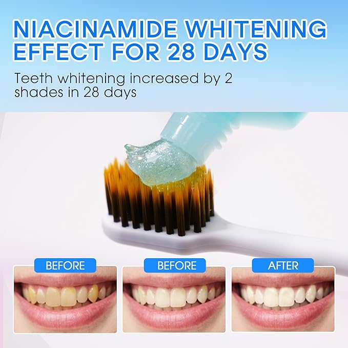 Hotluck Niacinamide Whitening Toothpaste - Brightening, Stain Removal, Freshening Breath - Deep Gentle Cleaning Tooth Paste, Boosting Gum Health, Mint & Peach 3.53oz (Pack of 3)