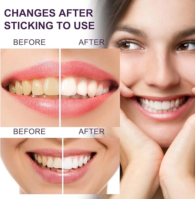 Purple Toothpaste for Teeth Whitening, Purple Whitening Toothpaste for Adults,Tooth Stain Remover Gel - Tooth Whitener Suitable for Smoking, Coffee, and Removing Dental Stone ﻿ (2fl oz/60ml) ﻿