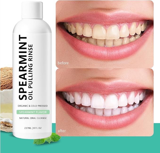 Spearmint Oil Pulling Mouthwash Rinse(237 ml), Cold-Pressed Coconut Mouthwash, Fresh Breath & Oral Care, Cleans Deeply Gentle Yet Effective (1)