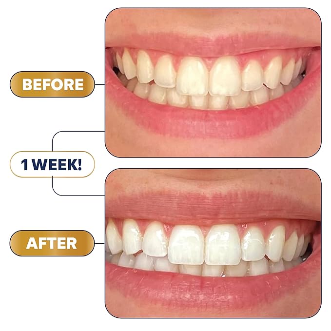 Lumineux Teeth Whitening Strips Kit - 21 Treatments - Peroxide Free - Enamel Safe for Whiter Teeth - Whitening Without The Sensitivity - Dentist Formulated - Sensitivity