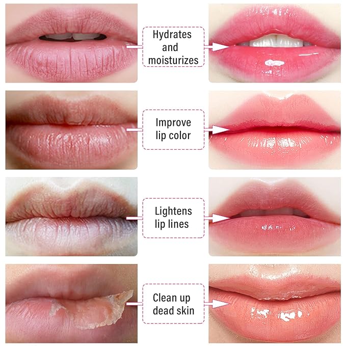 30 PCS Lip Mask Collagen Lip Masks Sheet for Dry Lips, Gel Lip Mask Pack for Remove Dead Skin, Moisturizes and Lightens Lip Lines (30 PCS, Watermelom Red)