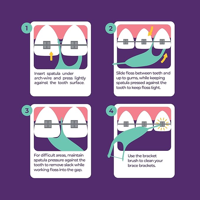 Platypus Orthodontic Flossers for Braces, 40 Count (Pack of 3), Ortho Picks for Adults & Kids, Fits Under Arch Wire, Non-Damaging, Encourage Flossing Habits