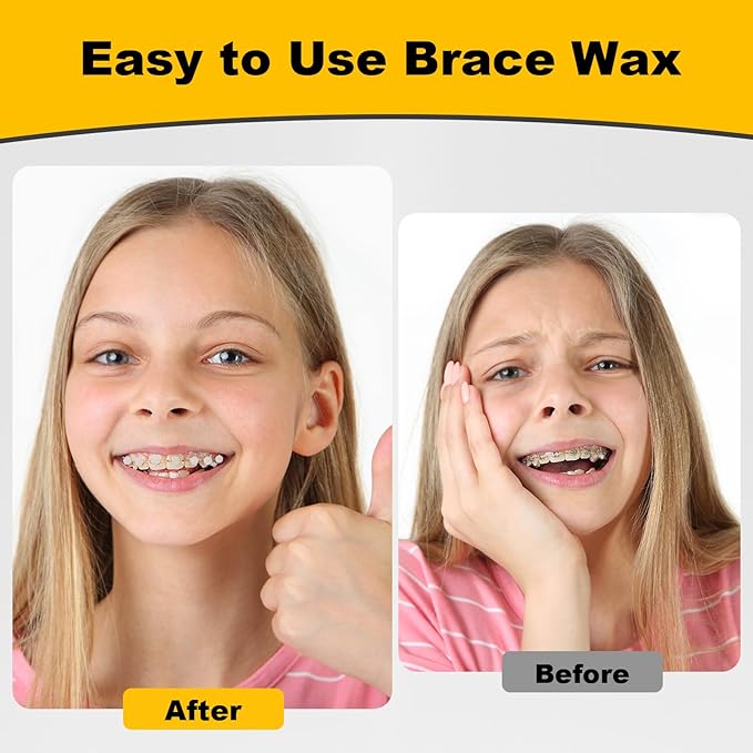 180PCS Braces Wax,Orthodontic Wax with Individual Packaging,Dental Waxs for Brace Travel Home Office,Mint