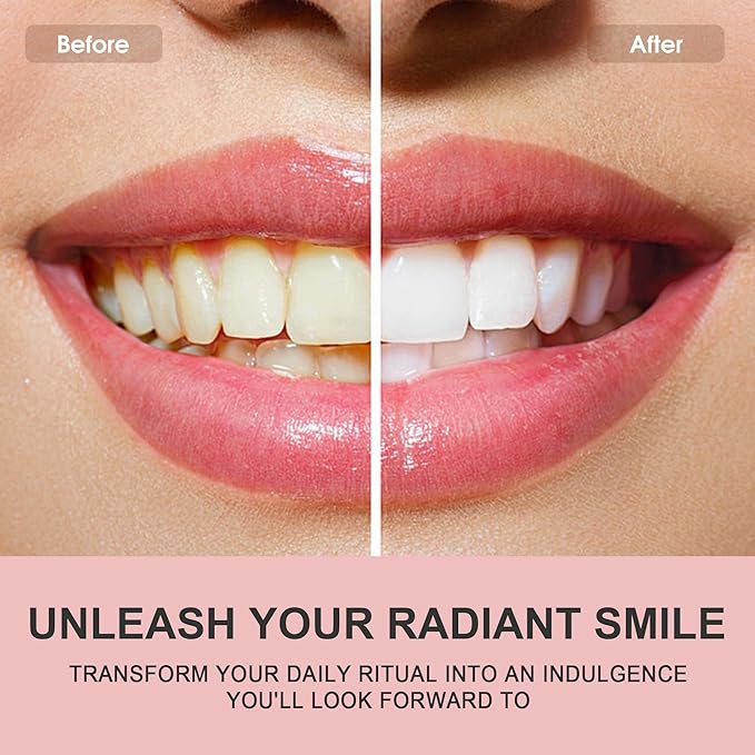Hotluck Niacinamide Whitening Toothpaste - Brightening, Stain Removal, Freshening Breath - Deep Gentle Cleaning Tooth Paste, Boosting Gum Health, Mint & Peach 3.53oz (Pack of 2)