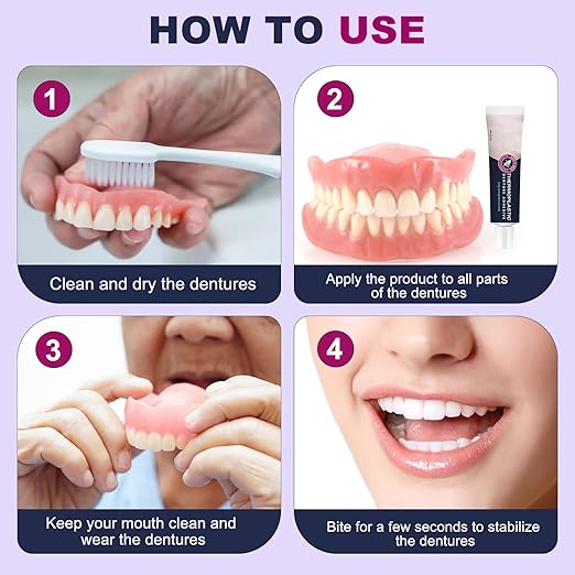 2PCS Thermoplastic Denture Adhesive, Ultra Max Hold Denture Adhesive, DentureAdhesive Fixing Paste, Fixed Dentures, Improving Comfort, Long-Lasting Durability