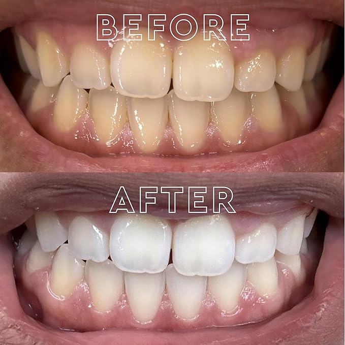 MOON Dissolving Teeth Whitening Strips, 56 No Rinse Nighttime White Strips, Midnight Mint, Enamel Pro+, Chamomile & Lavender, Whiten Sensitive Teeth up to 7 Shades in 4 Weeks, Vegan Oral Care