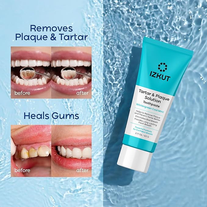 Plaque & Tartar Remover Toothpaste for Teeth: Removes Plaque & Controls Tartar Build-up - Long-Lasting Fresh Breath, Deep Cleansing & Gum-Friendly Formula, Wintergreen