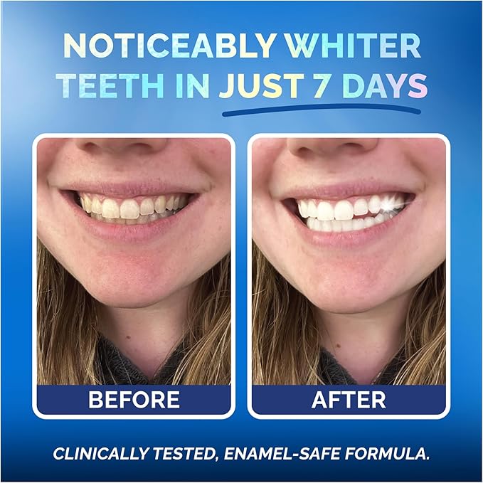 Whitening Strips for Sensitive Teeth – Enamel Safe, Peroxide-Free Coconut Teeth Whitening Strips with Natural Enzymes – Gentle White Stips for Sensitive Gums (28 Count (Pack of 1), Mint)